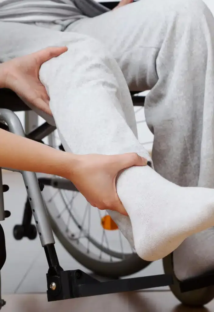 lawrence-dui-defense-img-704x1024 Person in gray sweatpants sitting in wheelchair with injured leg in white cast and sock elevated on footrest